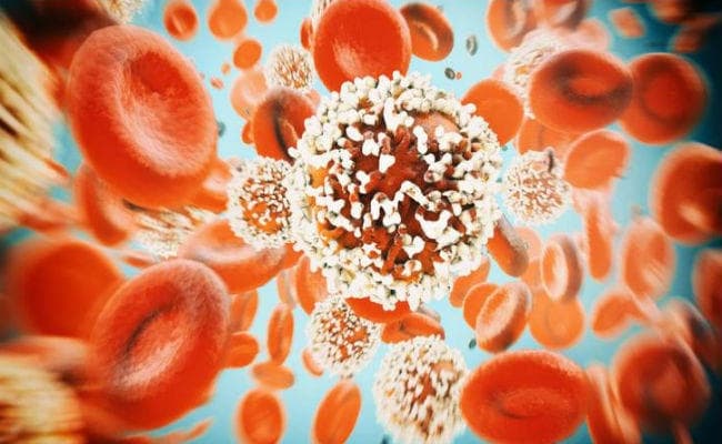 Tech News: लंच बाॅक्स के आकार का यह टूल लगायेगा कैंसर का पता