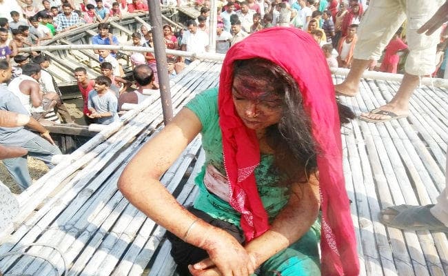 पुल से नीचे गिरी युवती फाउंडेशन पर अटकी, लोगों ने रेस्क्यू कर निकाला, देखें वीडियो