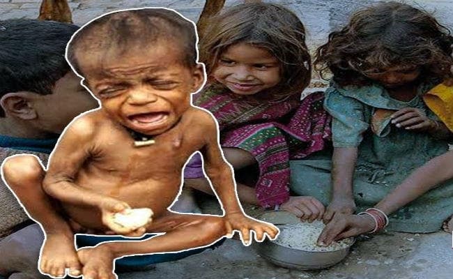 Global Hunger Index में 107 वें स्थान पर पहुंचा भारत, कांग्रेस-आप ने साधा निशाना