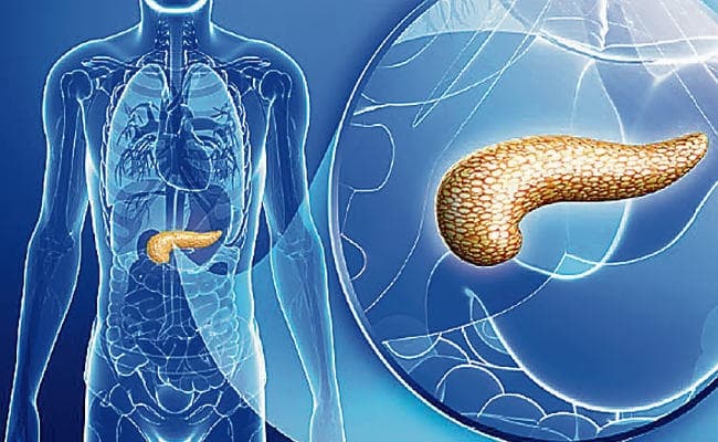 पैन्क्रियाज कैंसर का इलाज