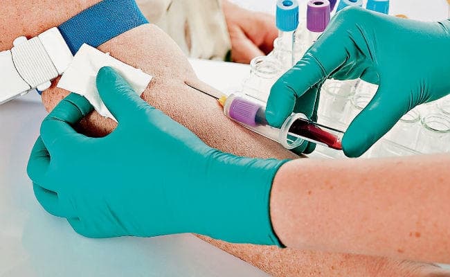 ब्लड टेस्ट से विलस का आकलन