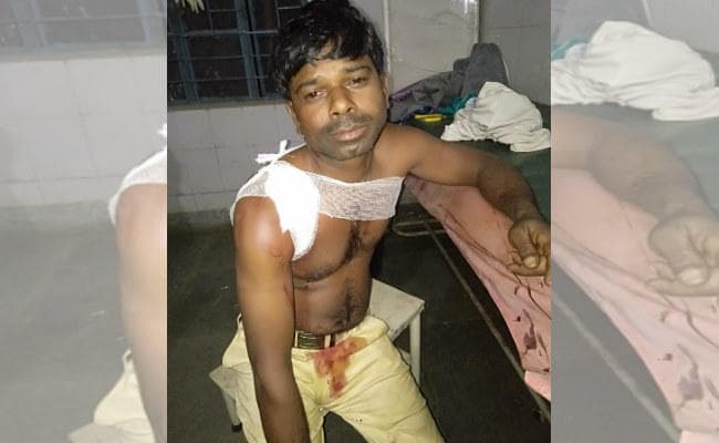 बड़कागांव : गोली लगने से एक शख्स गंभीर रूप से घायल, रांची रेफर