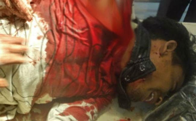 चौपारण : तेल मिल में फंसकर युवक का हाथ कटा, बाल-बाल बची जान