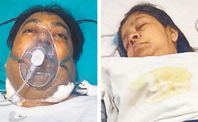 पटना : आइजीआइएमएस में हुआ 50वां सफल किडनी ट्रांसप्लांट, महिला ने किडनी देकर बचायी पति की जान