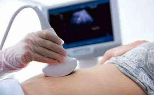 रांची : महिला डॉक्टर की गिरफ्तारी का विरोध, तीन दिन तक नहीं होगी गर्भवती की अल्ट्रासाउंड जांच