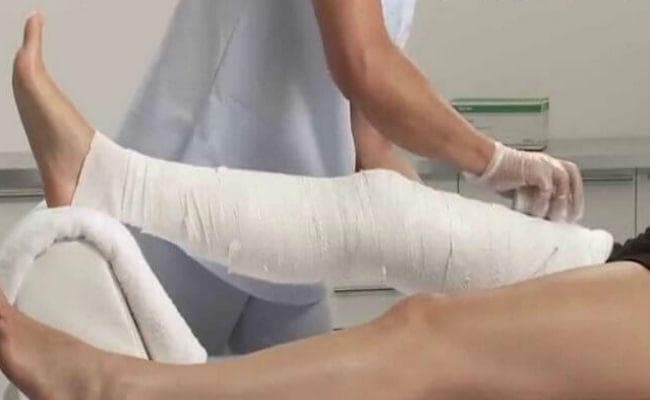 बंदरों से मोबाइल बचाने में गृहवधू छत से कूदी, दोनों पैर टूटे