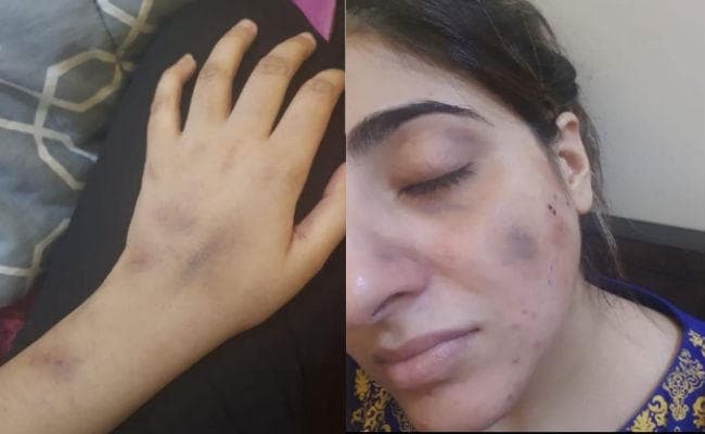 पाकिस्तानी अभिनेता की पत्नी का आरोप- मैं गर्भवती थी, मुझे जमीन पर घसीटा और…