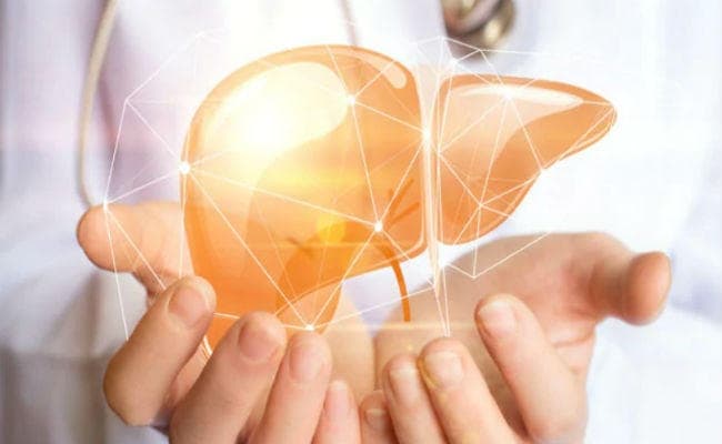 25 हजार लोगों को लीवर ट्रांसप्लांट की जरूरत : डॉ गोयनका