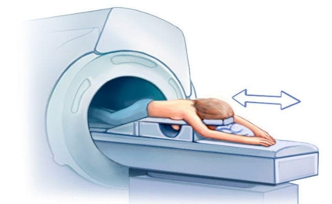 Study: स्तन कैंसर के खतरे का समय से पहले पता लगा सकता है MRI