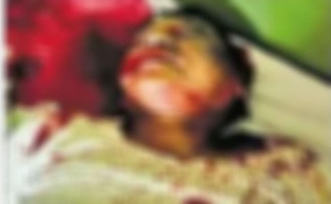 देवघर : डॉ विनोद पर घर में घुस कर हमला, कराहने की आवाज पर उठी नर्स फिर...