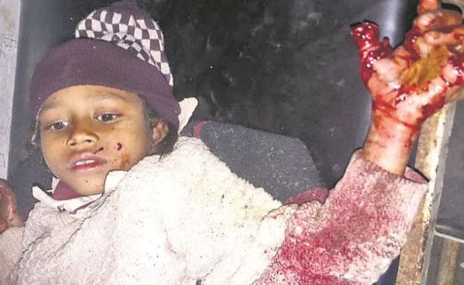 लातेहार के बरवाडीह स्थित मोरवाई जंगल की घटना, लकड़ी चुनने गयी बच्ची बम विस्फोट में घायल