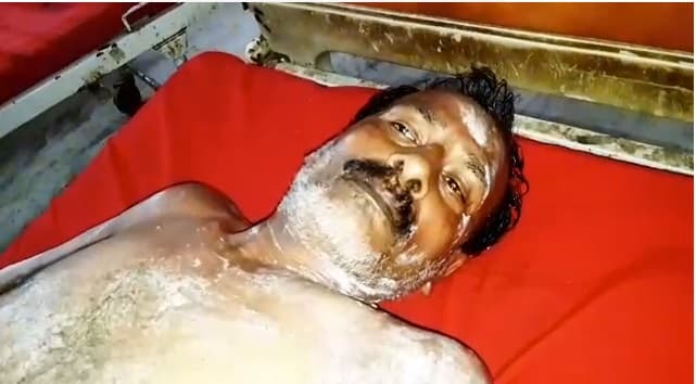 बिहार पंचायत चुनाव : हार से बौखलाये भतीजे ने चाचा और उसके परिवार पर फेंका तेजाब, 5 महिला समेत 7 झुलसे