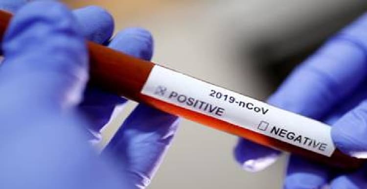 रेमडेसिविर और फेवीपिराविर नहीं हैं कोविड- 19 की लड़ाई में पासा पलटने वाली दवाएं