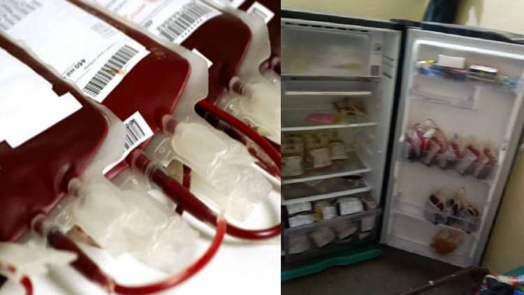 पटना में खून का काला धंधा: 156 मरीजों को चढ़वा दिया एक्सपायरी ब्लड, एक के बदले निकालते थे दो यूनिट खून