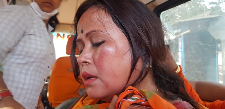 जेपी नड्डा के आने से पहले बंगाल में पुलिस ने BJP कार्यकर्ताओं पर चटकायी लाठियां, महिला का किया ये हाल