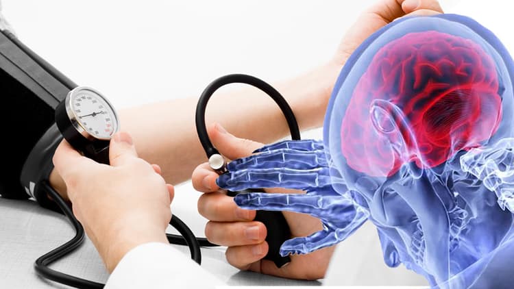 Winter Season Health Tips: बढ़ती ठंड में बीपी का उतार-चढ़ाव ब्रेन हेमरेज का बन सकता है कारण, जानें इसके लक्षण और बचाव के उपाय