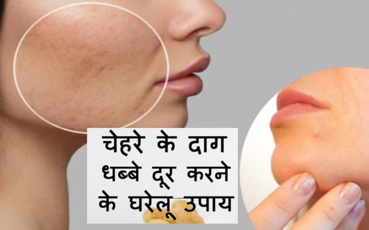 Beauty Tips: हेल्दी ग्लोइंग स्किन पाने के आसान घरेलू नुस्खे, दाग-धब्बे भी हो जाएंगे दूर करने,