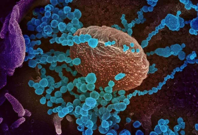 दुनिया से कोरोना खत्म हुआ नहीं और अब आ गया Chapare Virus का खतरा, इबोला जैसे हैं लक्षण