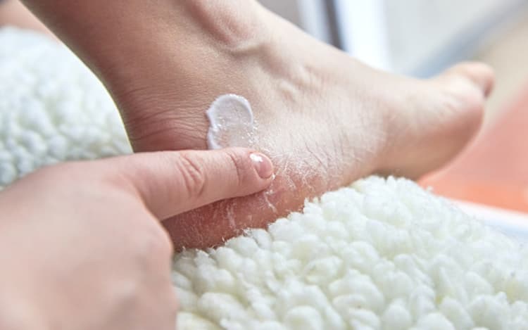 Treatment of Cracked Heels: इन 5 चीजों में छिपा है आपकी फटी एड़ियों का इलाज, अपनाएं ये टिप्स