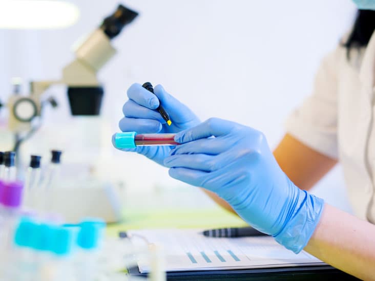 कोरोना के चार और संदिग्ध मिले, जांच के लिए भेजा गया ब्लड सैंपल