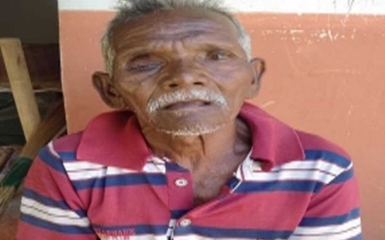 झारखंड : जमशेदपुर में नकली आंख लगाने के मामले में जांच पूरी, डीसी को सौंपी जायेगी रिपोर्ट