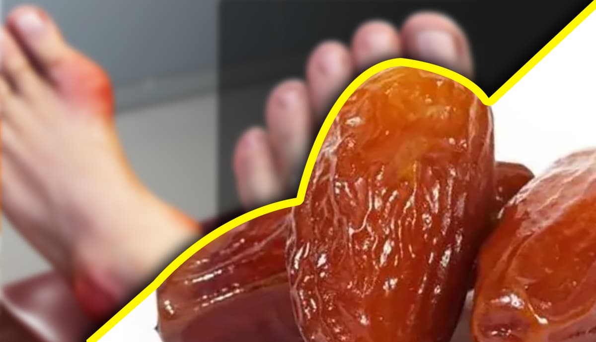 High Uric Acid को कम करता है खजूर, गठिया सहित इन रोगों का भी है रामबाण इलाज