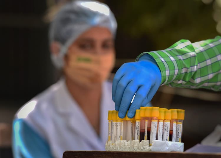 कोरोना संक्रमण के रिकॉर्ड 77,266 मामले, पांच दिन में बढ़े 3 लाख से ज्यादा केस