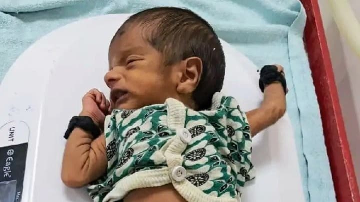 गोरखपुर: BRD मेडिकल कॉलेज में बजा इमरजेंसी अलार्म, कर्मचारियों के पहुंचने पर पालना आश्रय में रखा मिला नवजात