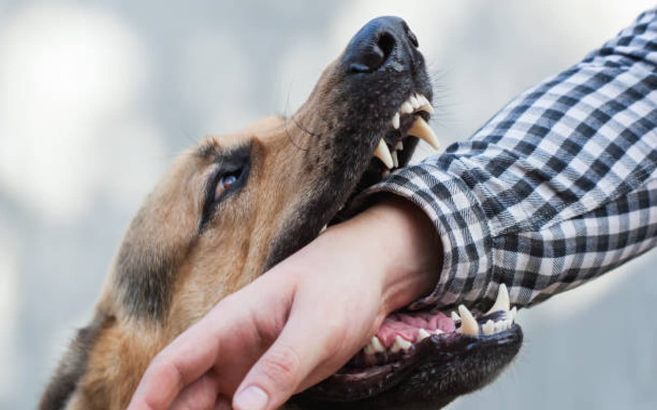 What To Do If Dog Bite: कुत्ते के काटने पर क्या करें, कब लगवाना चाहिए इंजेक्शन? जानें जरूरी बातें