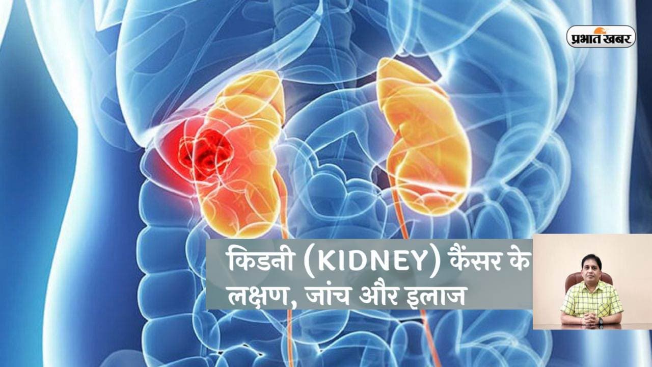 Kidney Cancer Signs, Symptoms and Treatment: क्या संभव है किडनी के कैंसर का इलाज, जानें डॉक्टर की राय