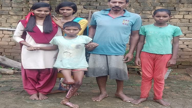 Jharkhand News: रसोई गैस हादसे में पत्नी व पुत्री की मौत के छह माह बाद भी दिव्यांग वासुदेव को नहीं मिला मुआवजा
