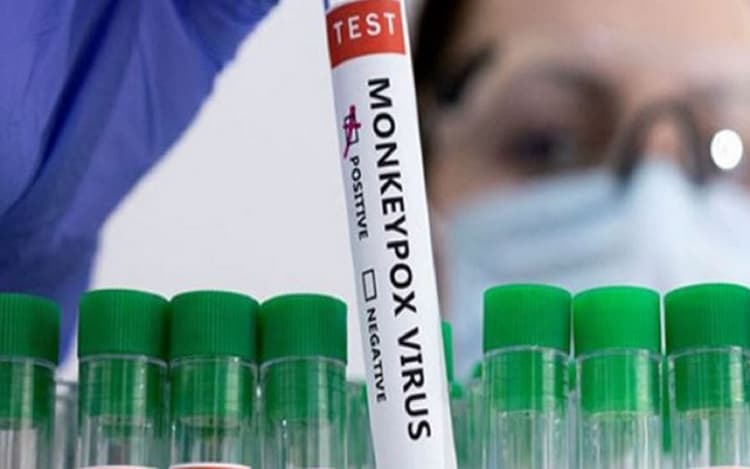 Monkeypox: ऑफिस में कंप्यूटर माउस या फिर कॉफी मशीन को भी छूने से हो सकता है मंकीपॉक्स, रिपोर्ट में खुलासा