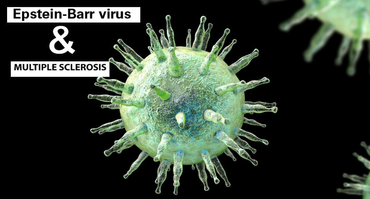 Epstein-Barr Virus और Multiple Sclerosis के बीच संबंध एक महत्वपूर्ण खोज