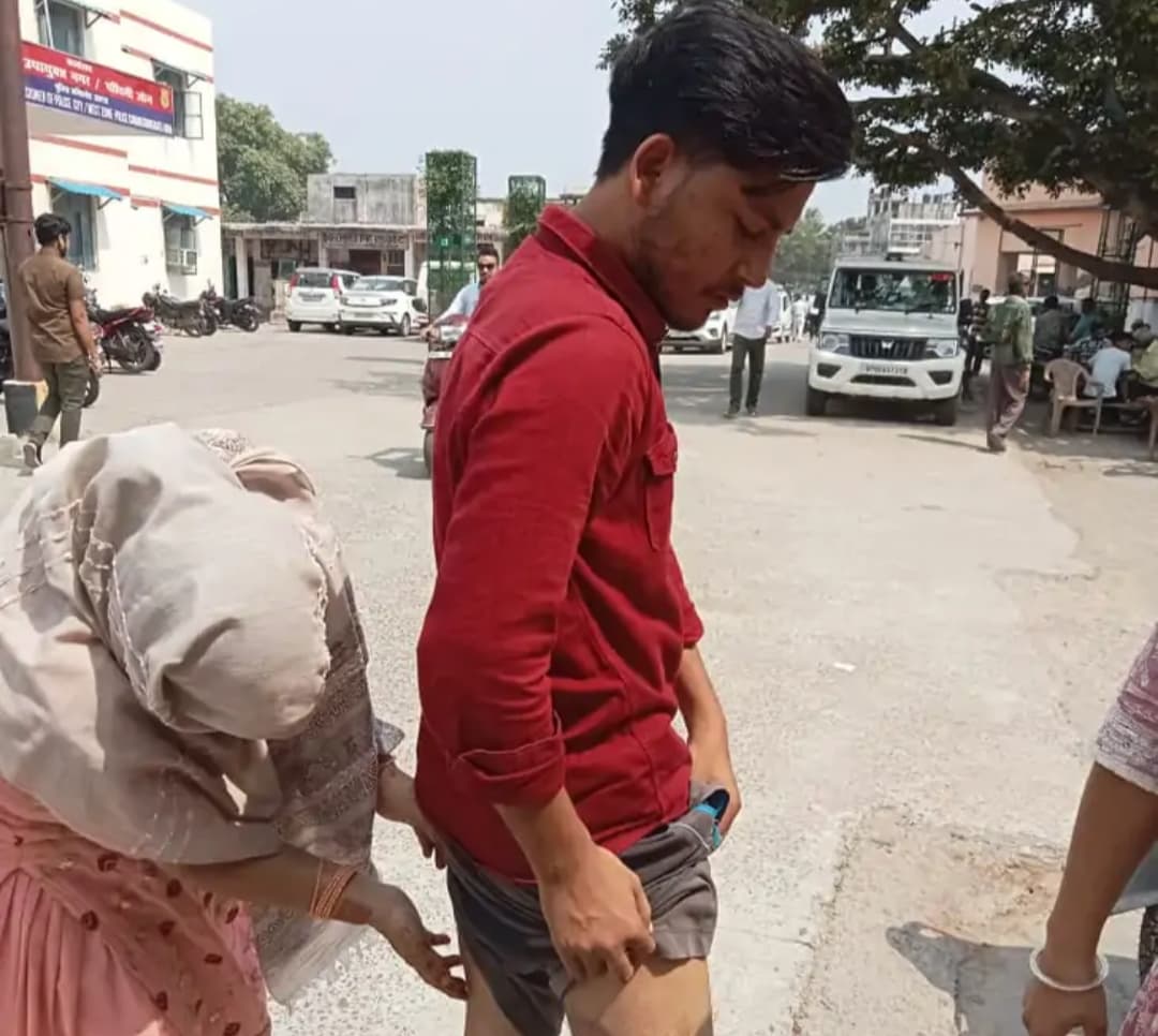 मोबाइल चोर बताकर युवक को थर्ड डिग्री दी, आरोपी दरोगा के खिलाफ अब जांच होगी मोबाइल चोर बताकर युवक को थर्ड डिग्री दी, आरोपी दरोगा के खिलाफ अब जांच होगी