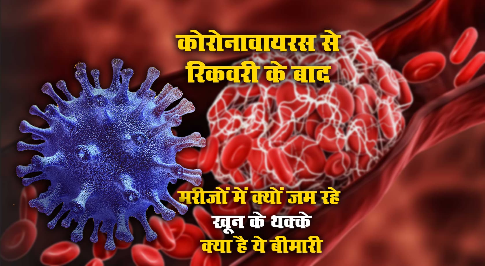 Covid Symptoms: क्यों कोविड के दौरान या रिकवरी के बाद मरीजों में जम रहे खून के थक्के, क्या है थ्रोम्बोसिस बीमारी, जानें कारण, लक्षण व उपचार Covid Symptoms: क्यों कोविड के दौरान या रिकवरी के बाद मरीजों में जम रहे खून के थक्के, क्या है थ्रोम्बोसिस बीमारी, जानें कारण, लक्षण व उपचार