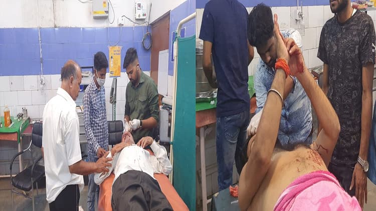 बिहार: औरंगाबाद में आपसी विवाद में जमकर चले लाठी डंडे, दो लोग गंभीर रूप से घायल