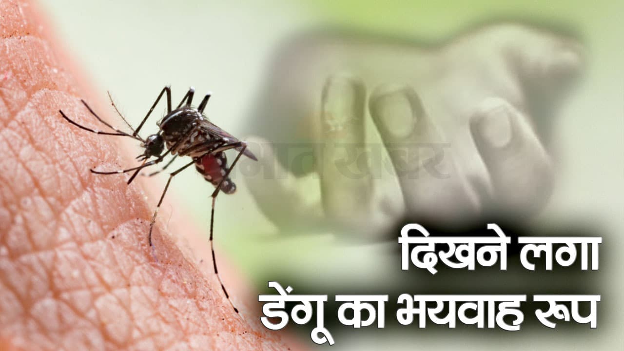 Video: बिहार में दिखने लगा डेंगू का खौफनाक रूप, भागलपुर और दरभंगा में मरीजों की मौत