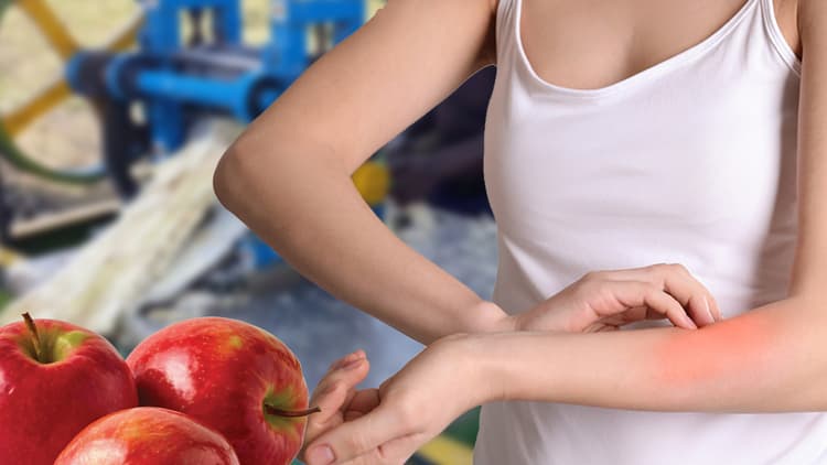 Summer Skin Care Tips: गर्मी के मौसम में होने वाली खुजली से राहत दिलायेंगे ये घरेलू उपाय