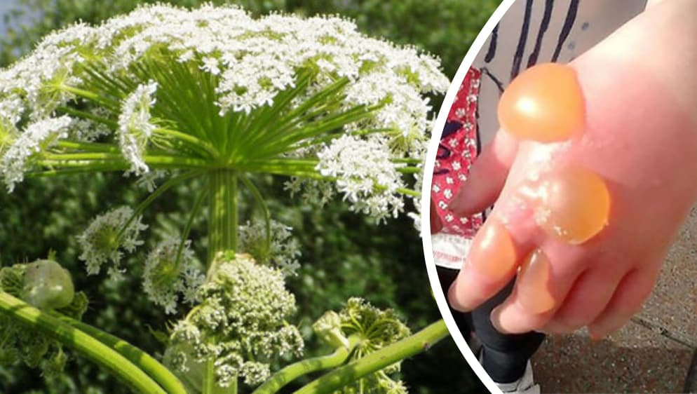 Jahrila Paudha: गाजर प्रजाति का ये पौधा किलर ट्री के नाम से है प्रसिद्ध, जिसके छूने मात्र से जा सकती है जान !