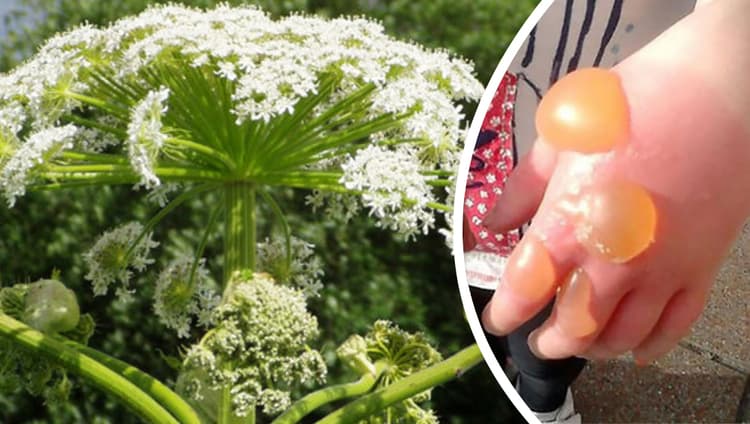 Jahrila Paudha: गाजर प्रजाति का ये पौधा किलर ट्री के नाम से है प्रसिद्ध, जिसके छूने मात्र से जा सकती है जान !