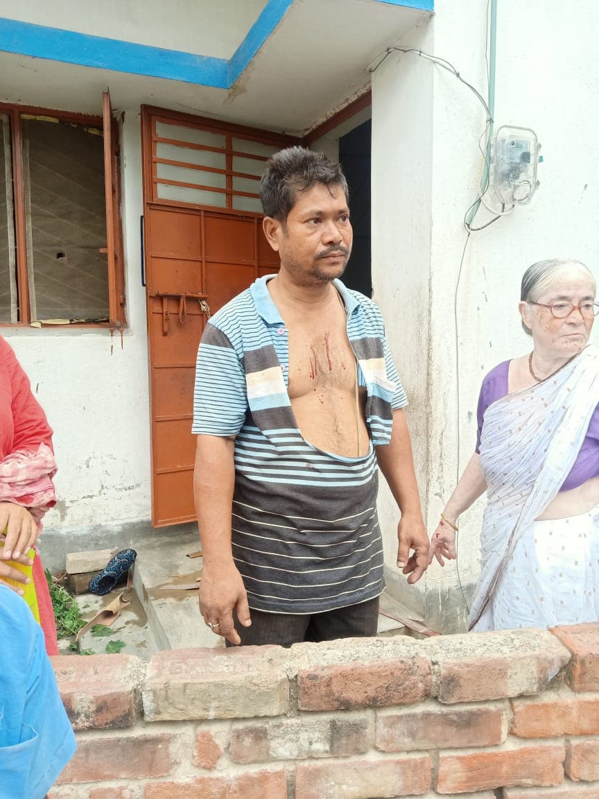 बंगाल में चुनावी हिंसा जारी, बीजपुर में BJP कार्यकर्ता समेत उसकी मां और पत्नी पर हमला, TMC पर आरोप बंगाल में चुनावी हिंसा जारी, बीजपुर में BJP कार्यकर्ता समेत उसकी मां और पत्नी पर हमला, TMC पर आरोप
