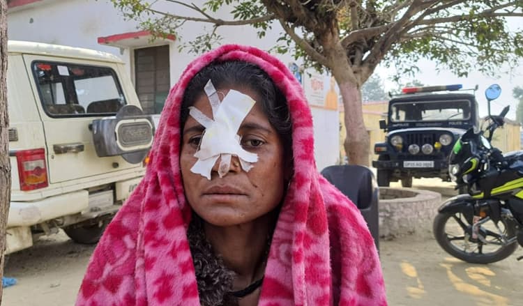 Bareilly News: पूर्व प्रधान के भाई ने चाकू से महिला की काटी नाक, मौके से हुआ फरार