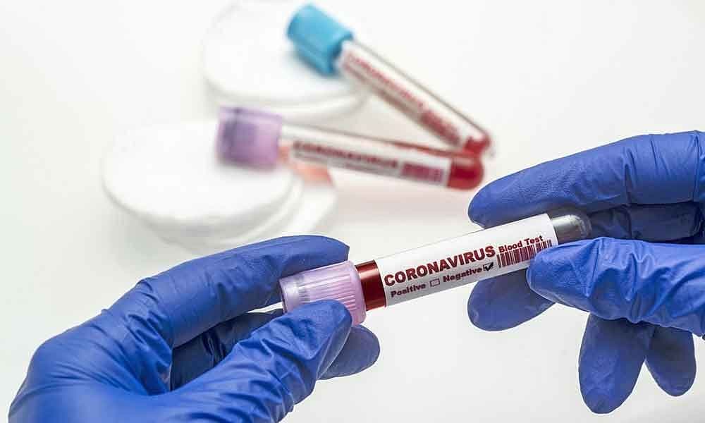 इंग्लैंड से मेरठ पहुंचे बेटा समेत दंपति मिले कोरोना पाॅजिटिव, जानिए कैसा है उनका स्वास्थ्य