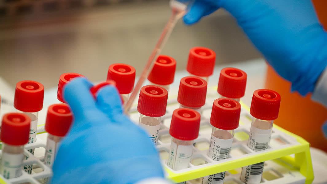 कोरोना जांच लैब : प बंगाल में 41, बिहार में 14 कोरोना जांच सेंटर, राज्य में आठ लैब में हो रही है जांच