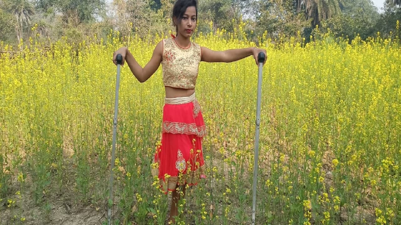 Jharkhand News: हादसे में पैर गंवाने के बाद भी नहीं हारी हिम्मत, एक पैर से डांस कर रेखा मचा रही धमाल