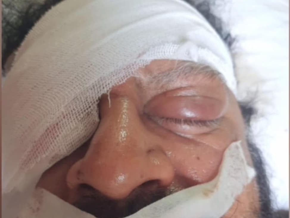 मेडिकल कारोबारी के साथ मारपीट में बीजेपी पार्षद पति अंकित शुक्ला समेत पांच नामजद, गिरफ्तारी को छापेमारी मेडिकल कारोबारी के साथ मारपीट में बीजेपी पार्षद पति अंकित शुक्ला समेत पांच नामजद, गिरफ्तारी को छापेमारी