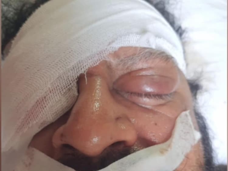 मेडिकल कारोबारी के साथ मारपीट में बीजेपी पार्षद पति अंकित शुक्ला समेत पांच नामजद, गिरफ्तारी को छापेमारी