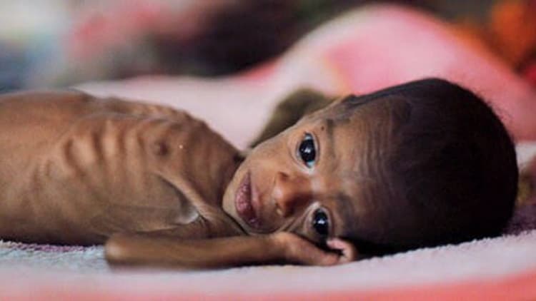 Hunger Index में कंगाल पाकिस्तान के बुरे हैं हालात, भुखमरी से निपटने के लिए भारत को करना होगा ये काम