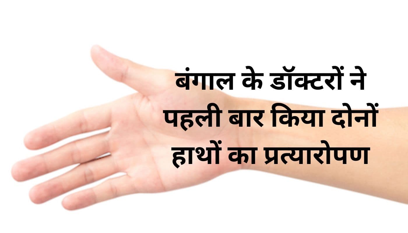 एसएसकेएम के 32 डॉक्टरों ने 22 घंटे के ऑपरेशन में किया हाथों का हुआ सफल प्रत्यारोपण