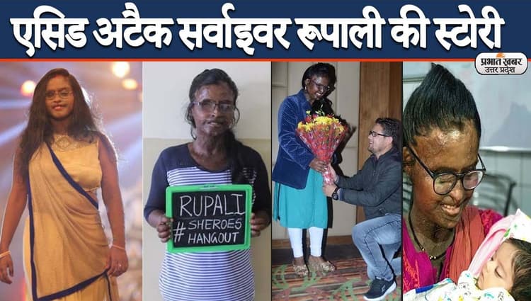 शीरोज की हीरो: एसिड अटैक सर्वाइवर रूपाली का संघर्ष, पिता ने ठुकराया, मां आज भी करती हैं कॉल
